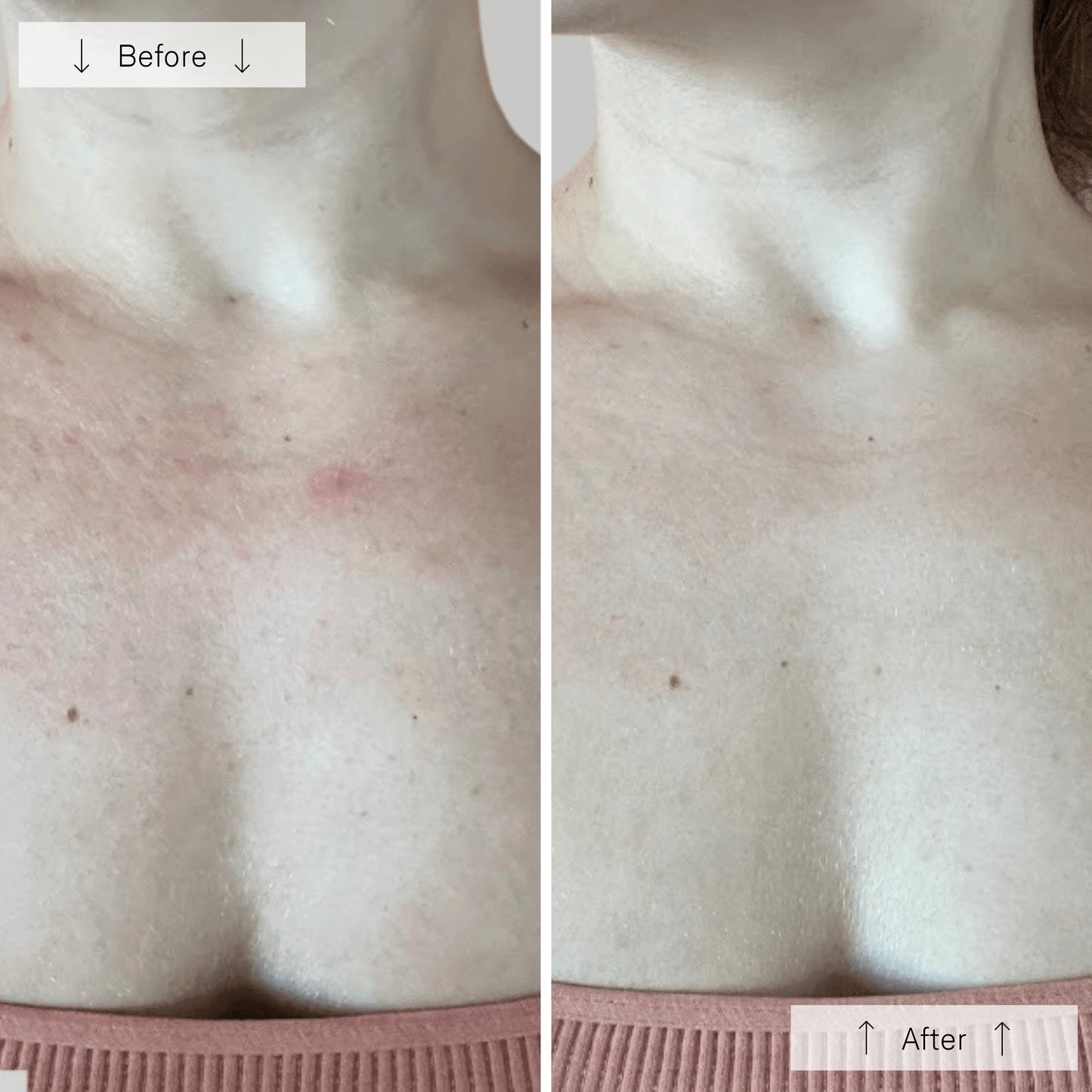 Omnilux Contour Neck & Decollete