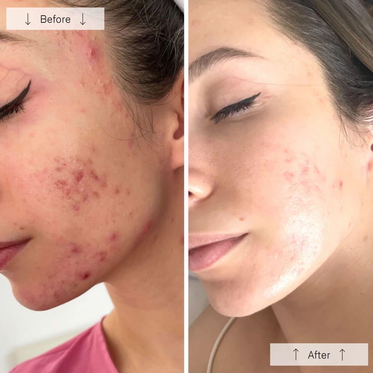 Omnilux Contour FACE